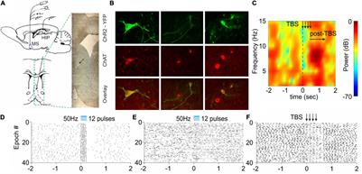 Basal Forebrain Impairment: Understanding the Mnemonic Function of the Septal Region Translates in Therapeutic Advances